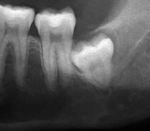 radiograph