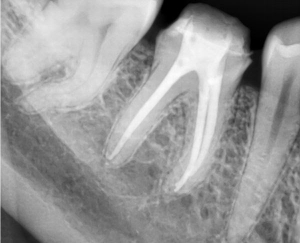 Endodontics